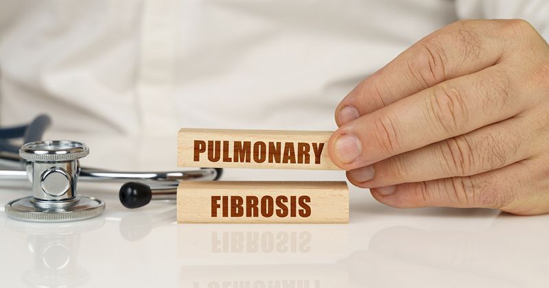 Blocks with the words pulmonary fibrosis on them.