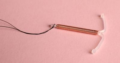 Intrauterine contraception just as effective as tubal ligation, safer