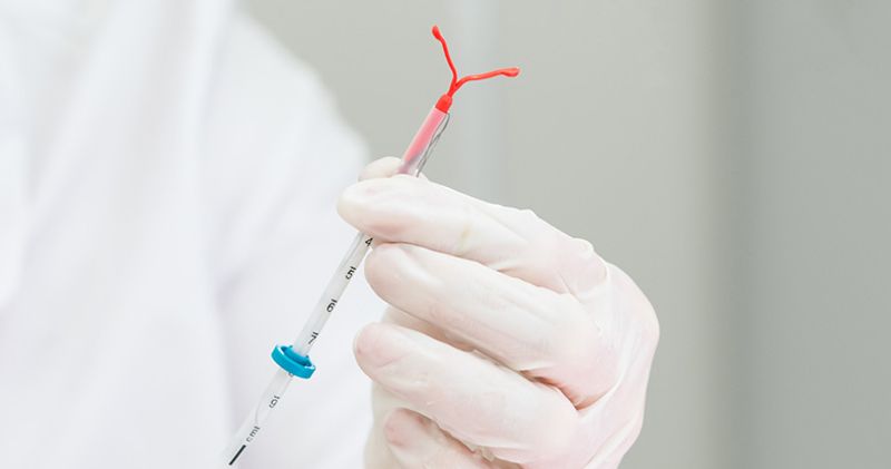 Researchers found that the lower the dose of an IUD, the higher the risk for an ectopic pregnancy. However, the absolute risk for ectopic pregnancy during the use of levonorgestrel-releasing intrauterine systems at any dose was low, they said. Source: Adobe Stock